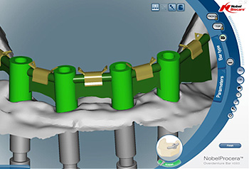 CAD/CAM モニター画面