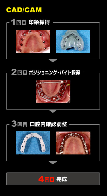 CAD/CAM 技工 ステップ